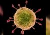 Covid-19: Finances locales & Coronavirus ; le coût flambe pour les collectivités coronavirus
